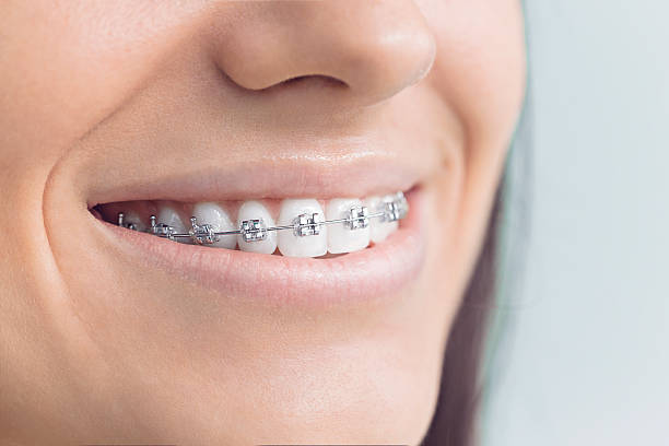 Best Wisdom Tooth Removal  in Margaret, AL